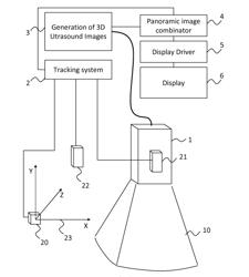 Method and apparatus for ultrasound image acquisition