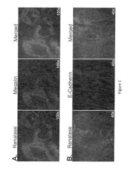 Compositions and Methods for Detecting, Treating and Preventing Diseases and Disorders