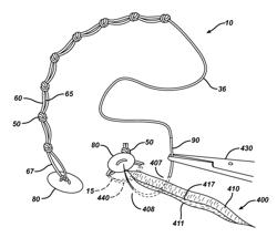 Knotless suture device