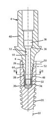 Arrangement for insertion of implants