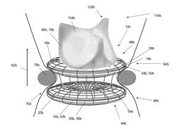 Implantation device