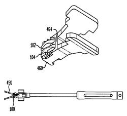 Intervertebral disc and insertion methods therefor