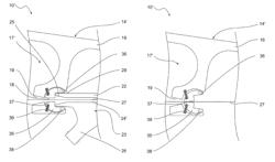 Guide wire fixation