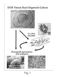 Methods of treating pre-malignant ductal cancer with autophagy inhibitors