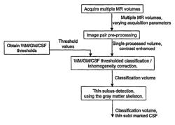 Brain tissue classification