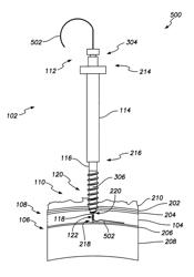 Apparatus and method for pericardial access