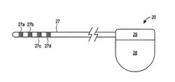 Apparatus and methods for rehabilitating a muscle and assessing progress of rehabilitation