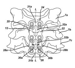 Spinal plate and drill guide