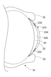 Microelectrodes in an Ophthalmic Electrochemical Sensor