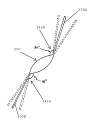 SEAMLESS-VISION, TILTED INTRAOCULAR LENS