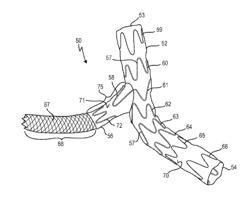 VASCULAR IMPLANT WITH SIDE BRANCH