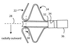 Anchor system for PFO closure