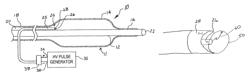 Shock wave catheter system with arc preconditioning