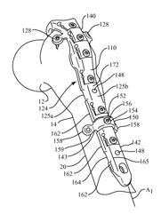 Periprosthetic plating system with compressive plate and transverse bridge plate