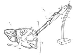 Multiple Treatment Zone Ablation Probe