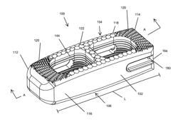 Intervertebral Implant