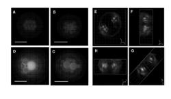 Biodegradable Microcapsules Containing Filling Material