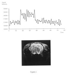 Method of imaging metabolic function