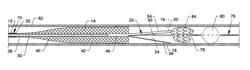 Catheter for removal of an organized embolic thrombus