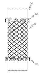 Apparatus and method for manufacturing a single wire stent