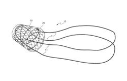 Bariatric device and method for weight loss