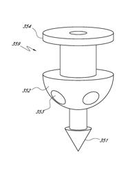 Ocular system with anchoring implant and therapeutic agent