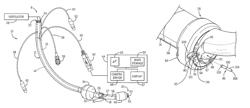 Tracheal tube with visualization device and integrated flushing system