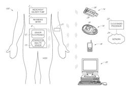 GLYCEMIC URGENCY ASSESSMENT AND ALERTS INTERFACE