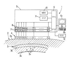 Method and apparatus for measuring heart contractility