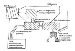 SYSTEMS AND METHODS TO DELIVER PHOTODISRUPTIVE LASER PULSES INTO TISSUE LAYERS OF THE ANTERIOR ANGLE OF THE EYE