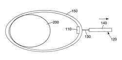 Microneedle array applicator and retainer