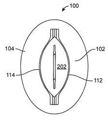 Rapid closing surgical closure device