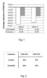 Method for treating psoriasis