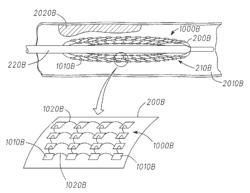 Systems, methods and devices having stretchable integrated circuitry for sensing and delivering therapy