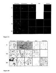 Accumulation of metabolic products in bacterial microcompartments