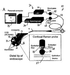 METHODS RELATED TO REAL-TIME CANCER DIAGNOSTICS AT ENDOSCOPY UTILIZING FIBER-OPTIC RAMAN SPECTROSCOPY