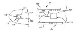 Method and apparatus for preparing organs and tissues for laparoscopic surgery