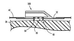 Shear resistant wound dressing for use in vacuum wound therapy