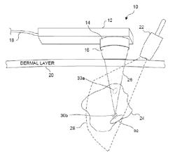 Ultrasound based method and apparatus for stone detection and to facilitate clearance thereof