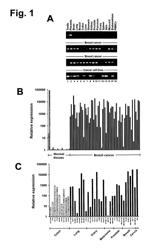 Monoclonal antibodies for treatment of cancer