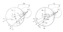 PAIR OF PROGRESSIVE OPHTHAMLIC LENSES