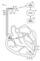 Integrating device-based sensors and bedside biomarker assays to detect worsening heart failure