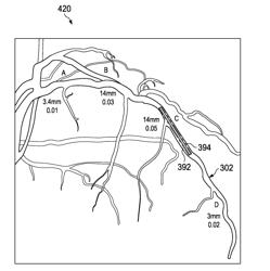 DEVICES, SYSTEMS, AND METHODS FOR TREATMENT OF VESSELS