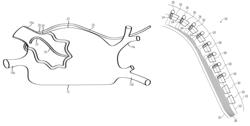 Pair of endocardial and epicardial catheters, catheter and method for positioning electrodes on a cardiac wall and method for the ablation of cardiac muscle tissue