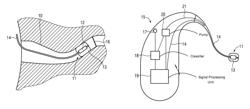 Method for operating a hearing aid and corresponding hearing aid