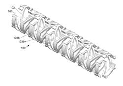 EXPANDABLE DEFORMABLE SLIDE AND LOCK STENT