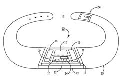 Integrated wireless non-invasive perfusion sensor and method of use