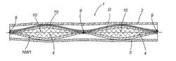 ABSORBENT SANITARY ARTICLE AND MACHINE FOR MAKING THE ARTICLE