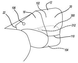 Two-way valve for multi-chambered airbags