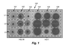 METHOD AND COMPOUND FOR TREATMENT OF CANCER USING PHOSPHOROUS-32 LABELED DNA